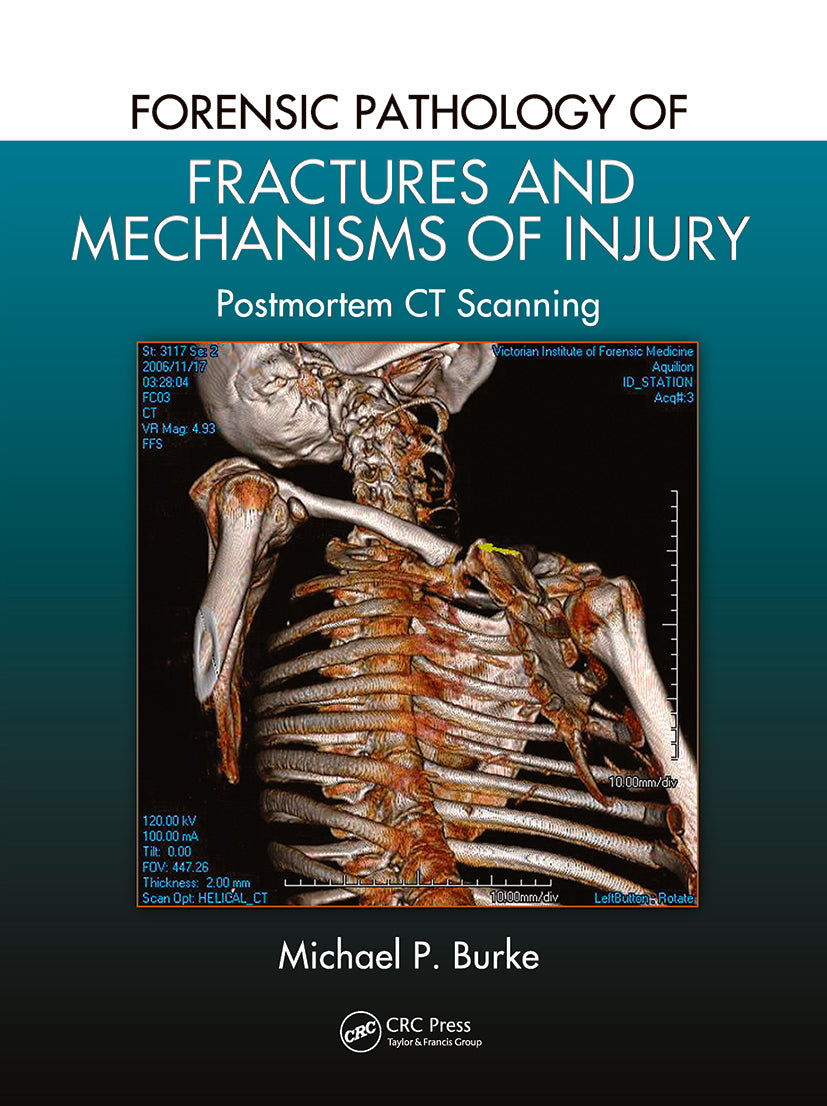 Forensic Pathology of Fractures and Mechanisms of Injury