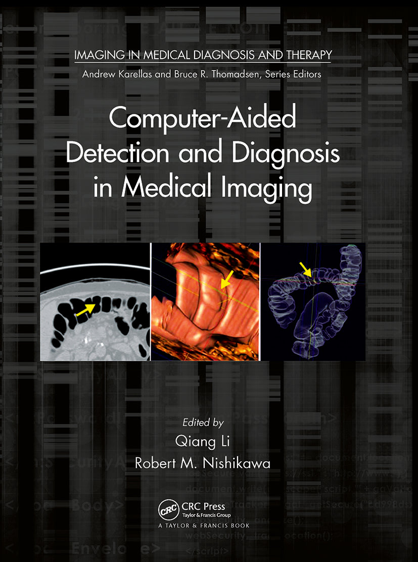 Computer-Aided Detection and Diagnosis in Medical Imaging