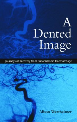 Dented Image