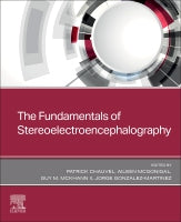 Stereoelectroencephalography