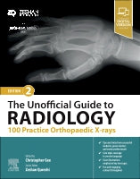 The Unofficial Guide to Radiology: 100 Practice Orthopaedic X Rays