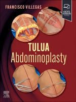 Abdominoplasty: Transverse Plication Technique