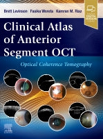 Clinical Atlas of Anterior Segment Ocular Coherence Tomography