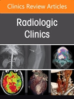 Spine Imaging, An Issue of Radiologic Clinics of North America