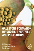 Gallstone formation, diagnosis, treatment & prevention