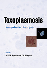 Toxoplasmosis