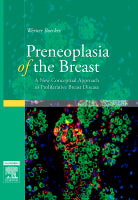 Preneoplasia of the Breast