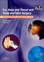 ICT Ear, Nose and Throat and Head and Neck Surgery 4e