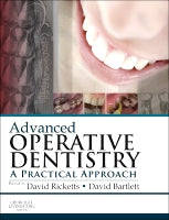 Advanced Operative Dentistry Print Only 1e