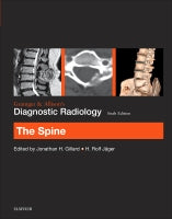Grainer & Allison's Diagnostic Radiology:                       The Spine