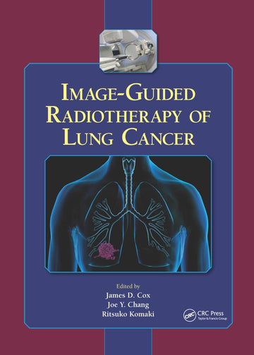 Image-Guided Radiotherapy of Lung Cancer