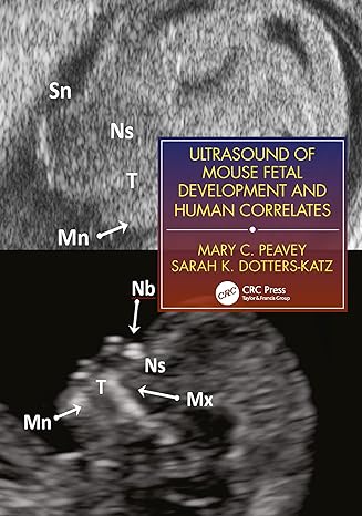 Ultrasound of Mouse Fetal Development and Human Correlates - Hardback