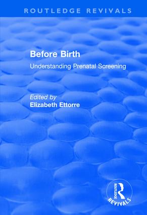 Before Birth - Paperback / softback