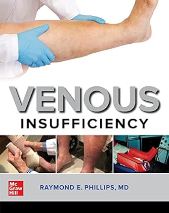 Venous Insufficiency