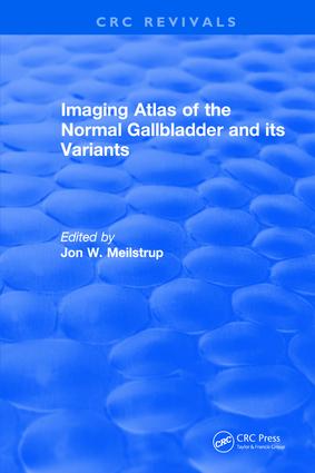 Imaging Atlas of the Normal Gallbladder and Its Variants