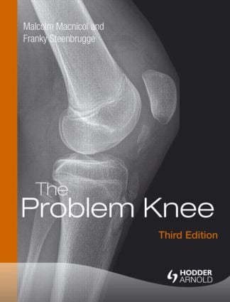 Problem Knee