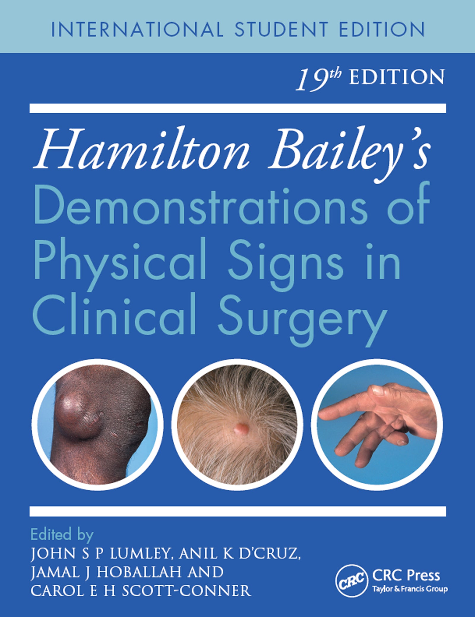 Hamilton Bailey's Physical Signs