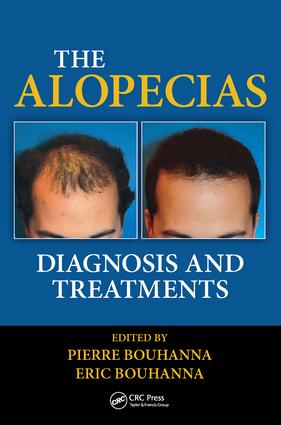 Alopecias