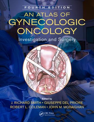 Atlas of Gynecologic Oncology
