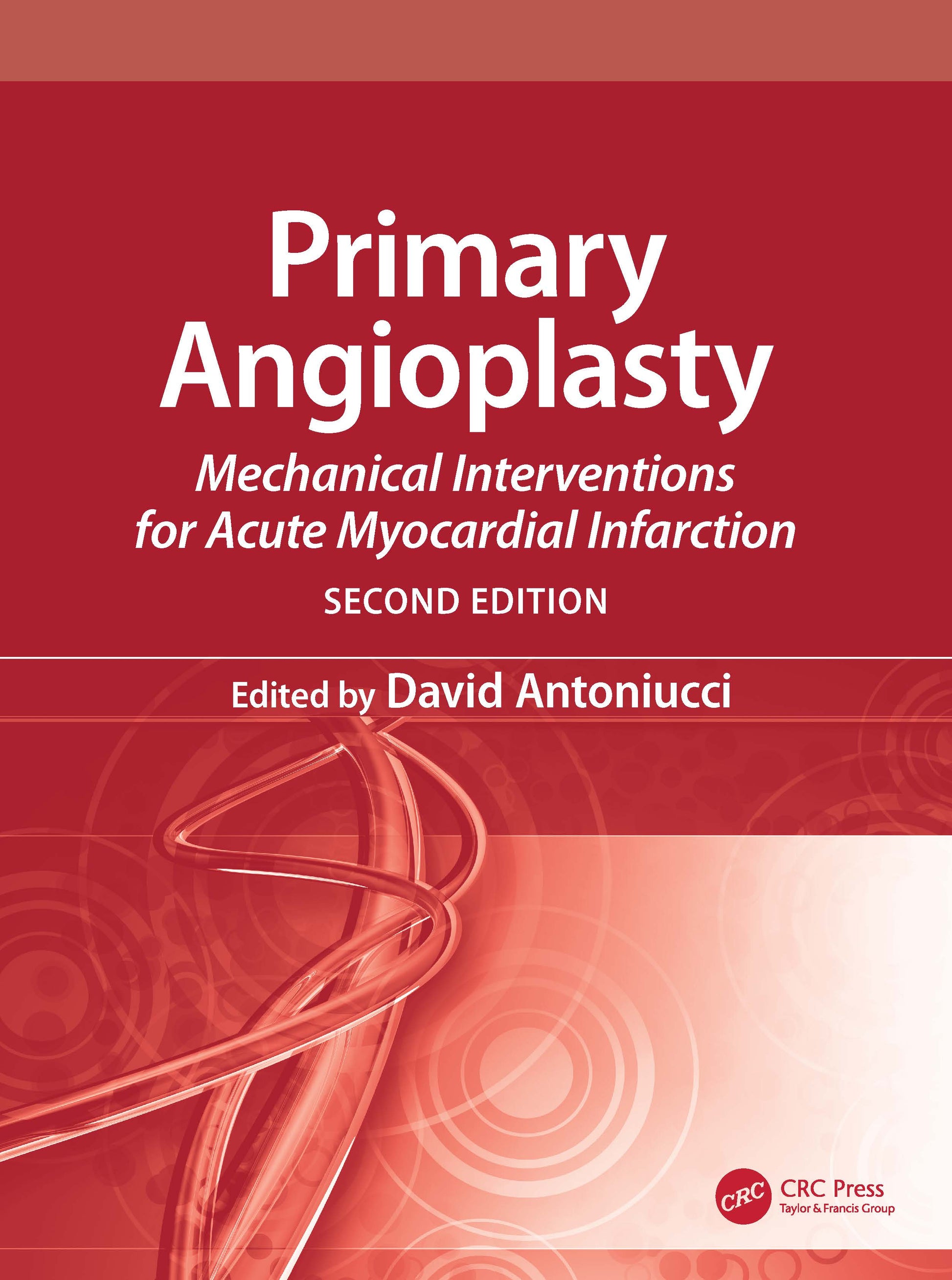 Primary Angioplasty