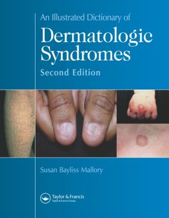 Illustrated Dictionary of Dermatologic Syndromes