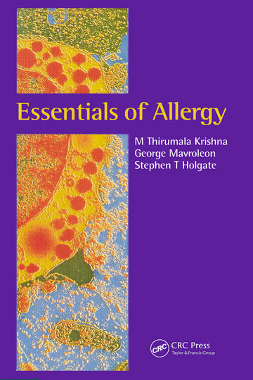 Essentials of Allergy