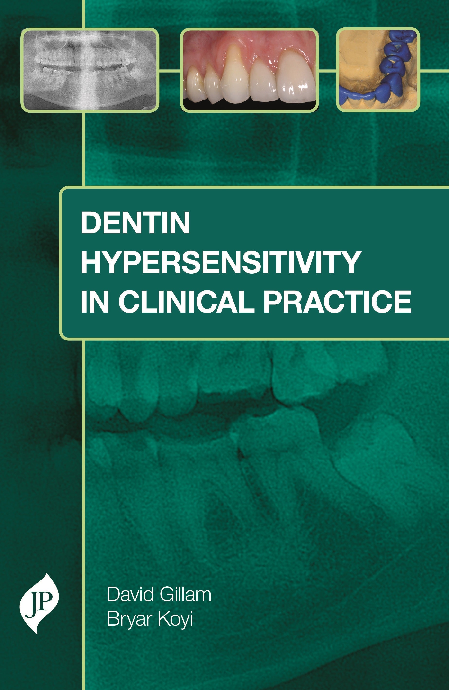 Dentin Hypersensitivity in Clinical Practice