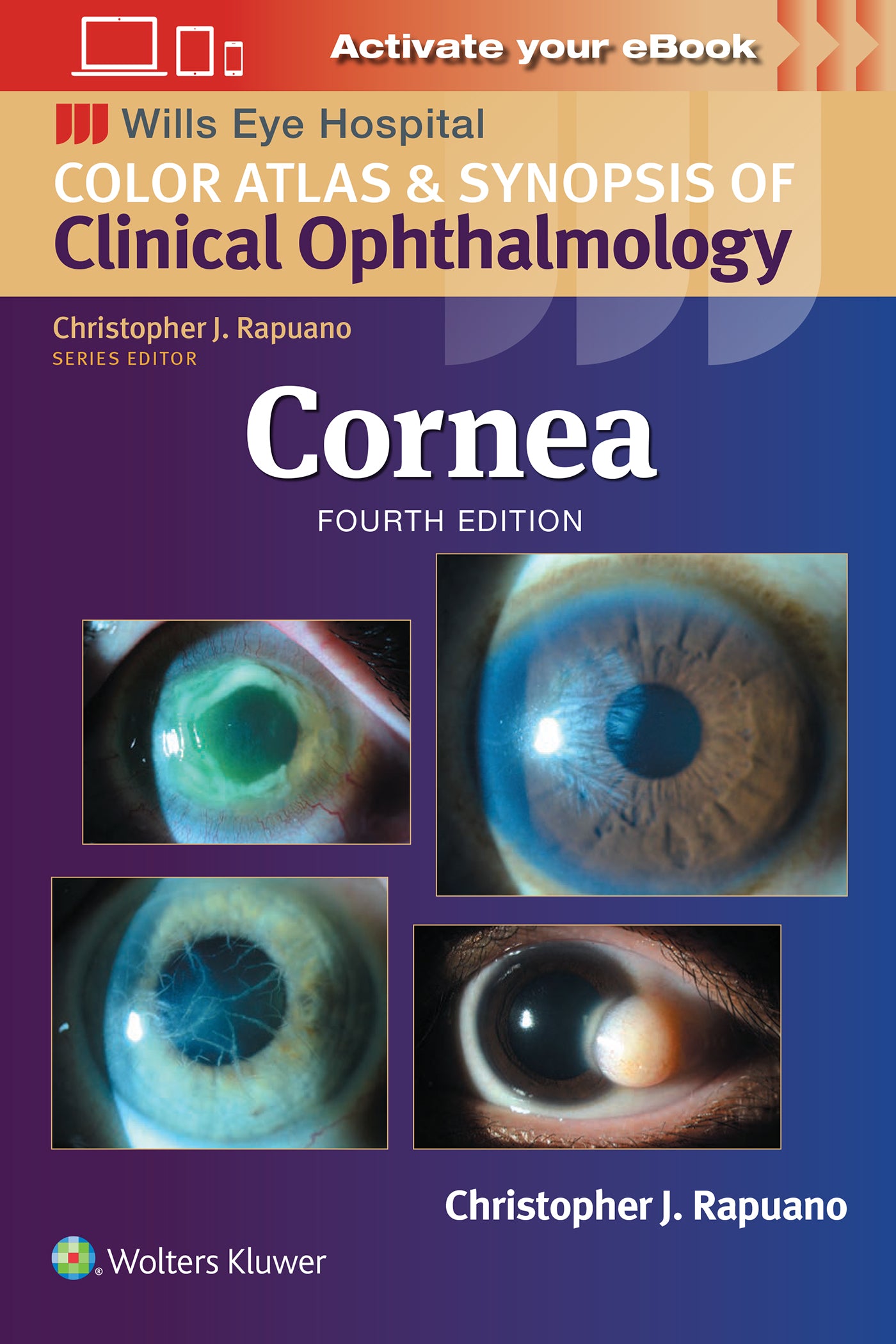 Cornea ( Color Atlas and Synopsis of Clinical Ophthalmology)