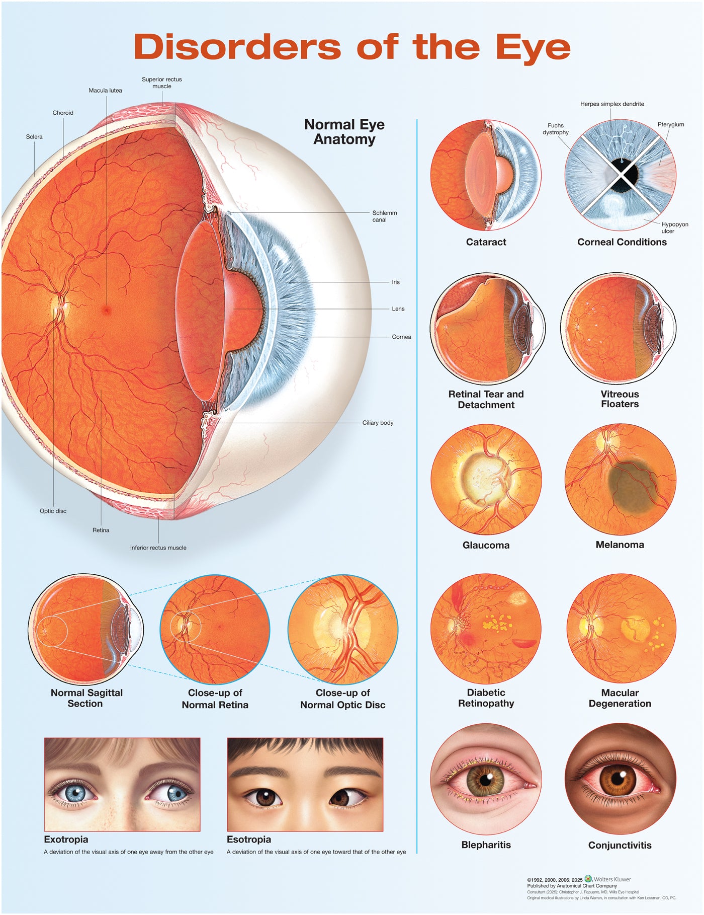 Disorders of the Eye Anatomical Chart laminated
