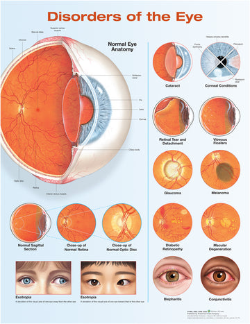 Disorders of the Eye Anatomical Chart laminated