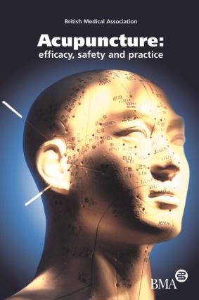 Acupuncture
