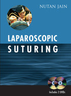 Laparoscopic Suturing