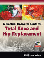 A Practical Operative Guide for Total Knee and Hip Replacement