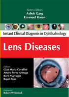 Lens Diseases