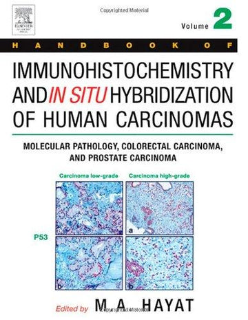Handbook of Immunohistochemistry and in Situ Hybridization of Human Carcinomas