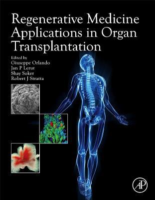 Regenerative Medicine Technology as Applied to Organ Transplantation