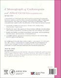 A Monograph of Codonopsis and Allied Genera (Campanulaceae s. str.)