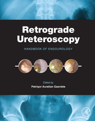 Retrograde Ureteroscopy: Handbook of Endourology