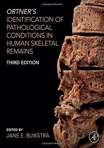Identification of Pathological Conditions in Human Skeletal Remains