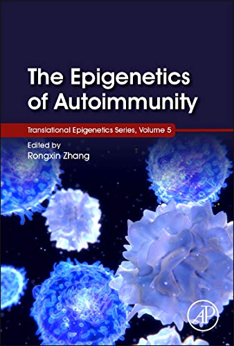 Autoimmunity Epigenetics