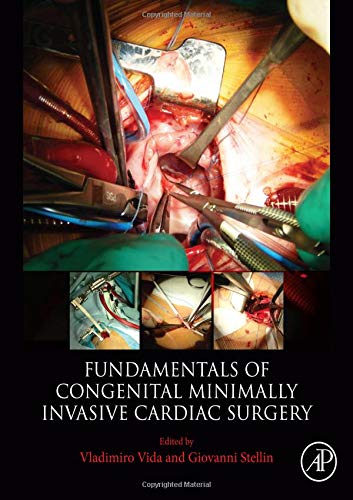 Fundamentals of Pediatric Minimally Invasive Cardiac Surgery