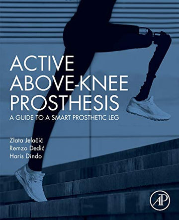 Active above-knee prosthesis: A guide to a smart prosthetic leg
