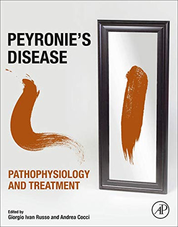 Peyronie's Disease: Pathophyisology and Treatment