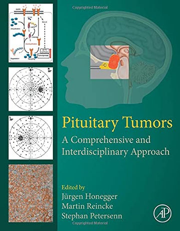 Pituitary Tumors: A Comprehensive and Interdisciplinary Approach