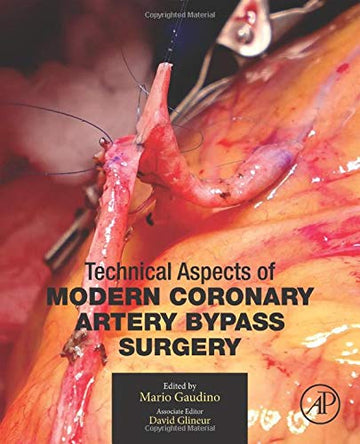 Technical Aspects of Modern Coronary Artery Bypass Surgery