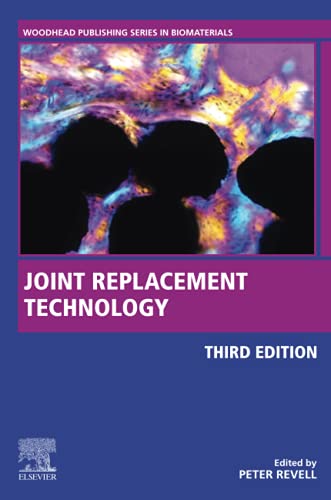 Joint Replacement Technology
