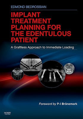 Treatment Planning for the Edentulous Patient