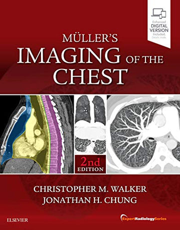 Muller's Imaging of the Chest:Expert Radiology Series:Expert Radiology