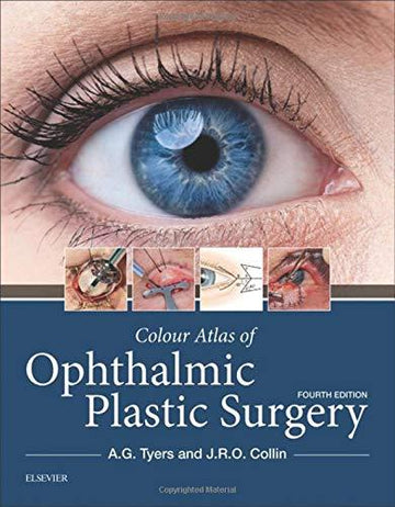 Colour Atlas of Ophthalmic Plastic Surgery