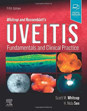 Uveitis: Fundamentals and Clinical Practice
